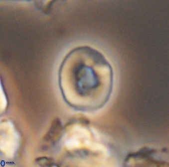 Crepidolithus perforatus 10995