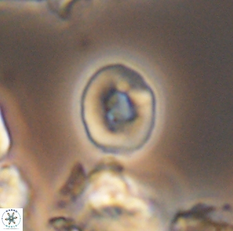 Crepidolithus perforatus 10995