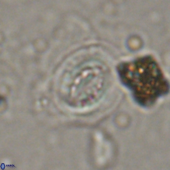 Cribrocentrum ornatus 15502