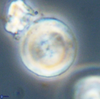 Cribrocentrum erbae VR 33674