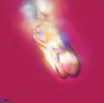 Cribrocentrum erbae VR 33677