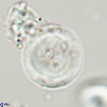 Cribrocentrum erbae VR 33673