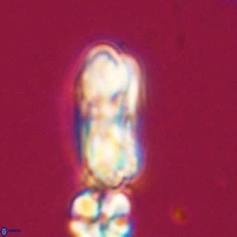 Cribrocentrum erbae VR 33684