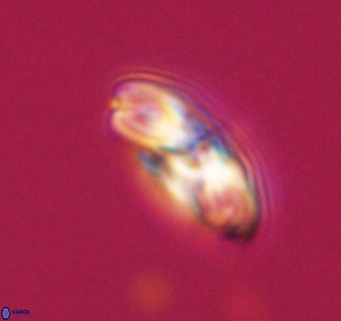 Cribrocentrum reticulatum VR 33787