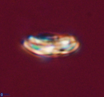 Cribrocentrum reticulatum VR 33794