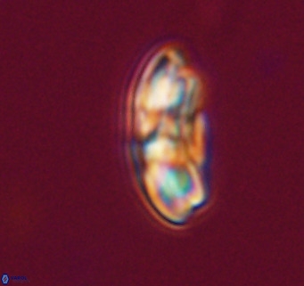 Cribrocentrum reticulatum VR 33791