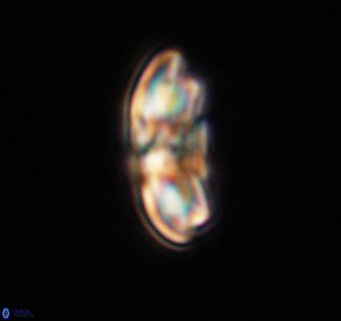 Cribrocentrum reticulatum VR 33792
