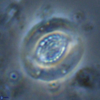 Cribrocentrum retiformis 14966