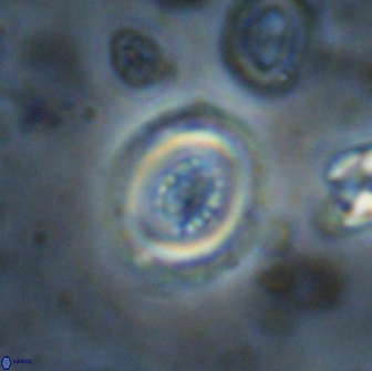 Cribrocentrum retiformis 14993