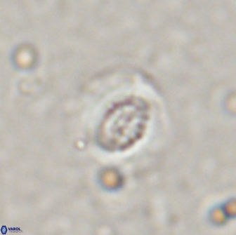 Cribrocentrum retiformis 15512