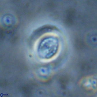 Cribrocentrum retiformis 15514