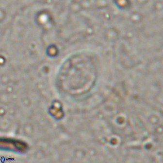 Cribrocentrum retiformis 15524