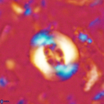 Cribrocentrum sp VR 02709