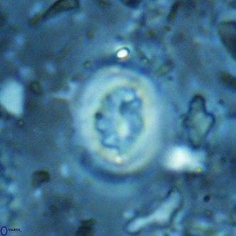 Cribrocentrum sp VR 02715