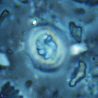 Cribrocentrum sp VR 02716