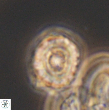 Cribrocorona gallica 12041