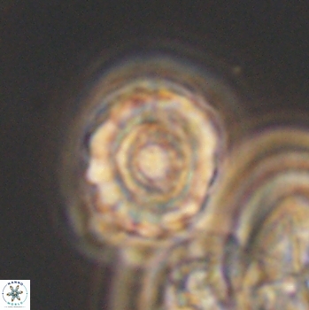 Cribrocorona gallica 12042