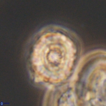 Cribrocorona gallica 12043