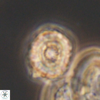 Cribrocorona gallica 12043