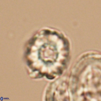 Cribrocorona gallica 12044