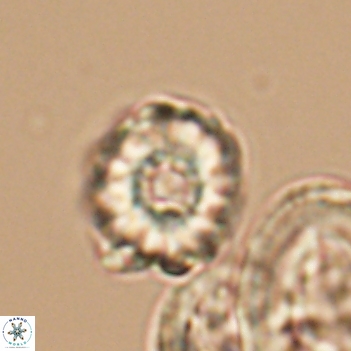 Cribrocorona gallica 12044