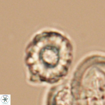 Cribrocorona gallica 12045