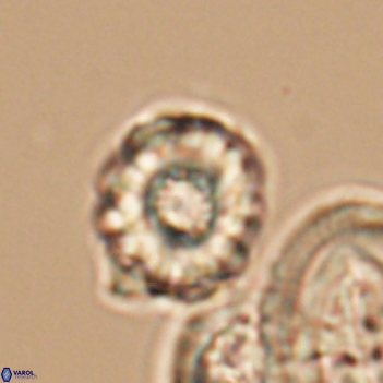 Cribrocorona gallica 12046