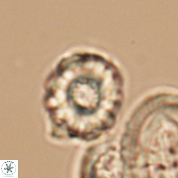 Cribrocorona gallica 12046