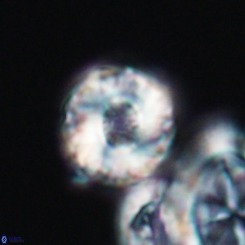 Cribrocorona gallica 12047