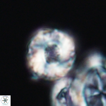 Cribrocorona gallica 12047