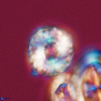 Cribrocorona gallica 12048