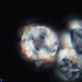 Cribrocorona gallica 12052