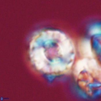 Cribrocorona gallica 12053