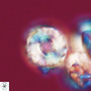 Cribrocorona gallica 12053