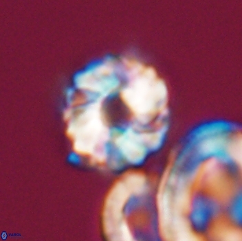 Cribrocorona gallica 12054