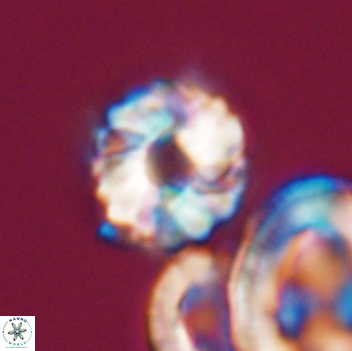 Cribrocorona gallica 12054