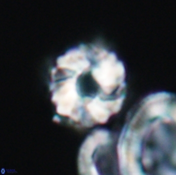 Cribrocorona gallica 12055