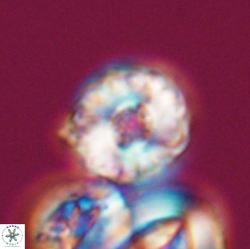 Cribrocorona gallica 12058
