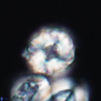 Cribrocorona gallica 12059