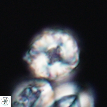 Cribrocorona gallica 12059