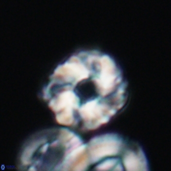 Cribrocorona gallica 12060