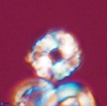 Cribrocorona gallica 12061