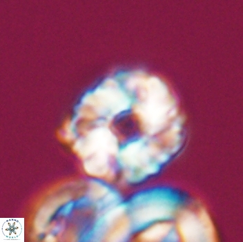 Cribrocorona gallica 12061