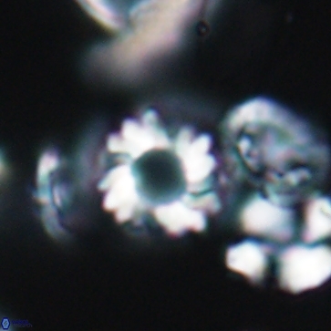 Cribrocorona gallica 12165