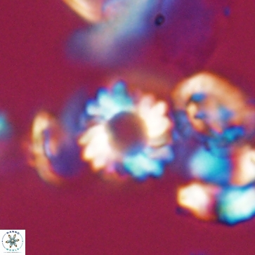 Cribrocorona gallica 12166