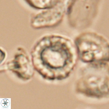 Cribrocorona gallica 12168