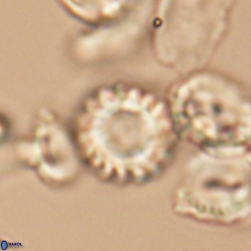 Cribrocorona gallica 12169