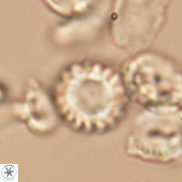 Cribrocorona gallica 12169