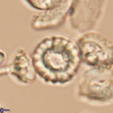 Cribrocorona gallica 12170