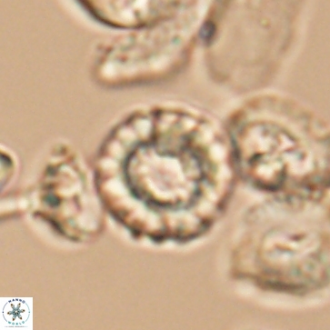 Cribrocorona gallica 12170